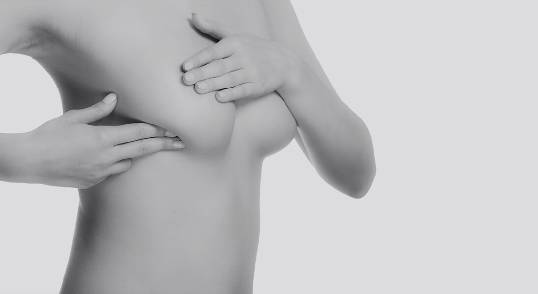 mastopexy breast lift surgery houston