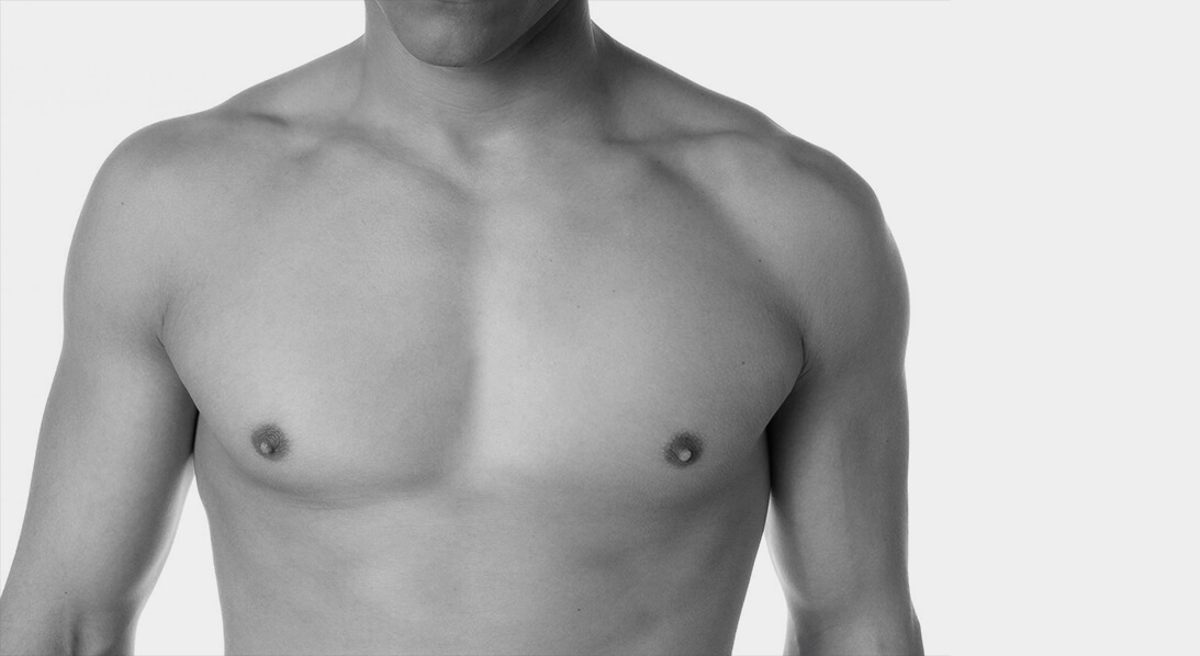 male breast reduction houston