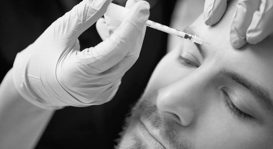 male face microneedling plastic surgeon houston